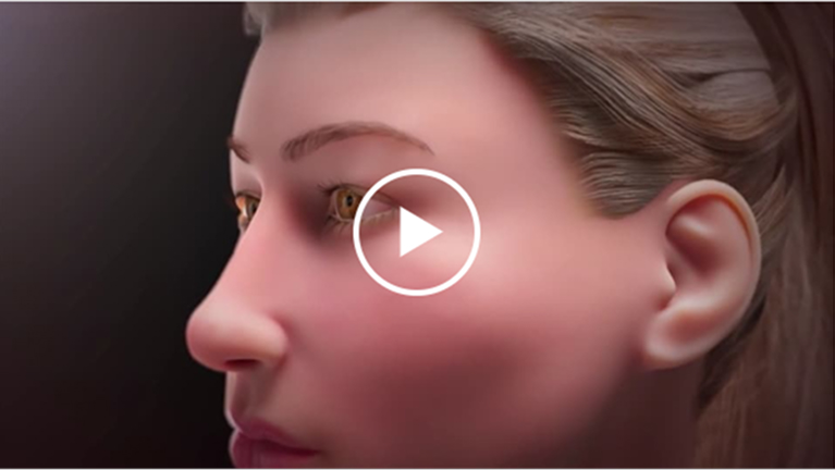 A Background on Thyroid Eye Disease