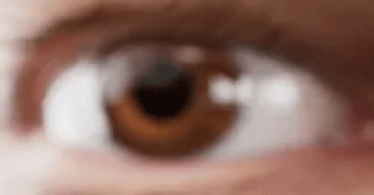 blurry-vision