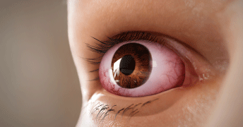 eye-bulging