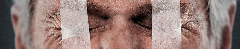 Thyroid Eye Disease Risk Factors