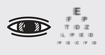 Vision floue